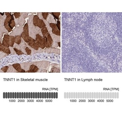 Troponin T type 1 (slow skeletal) Antibody, Novus Biologicals 0.1mL; Unlabeled:Antibodies,